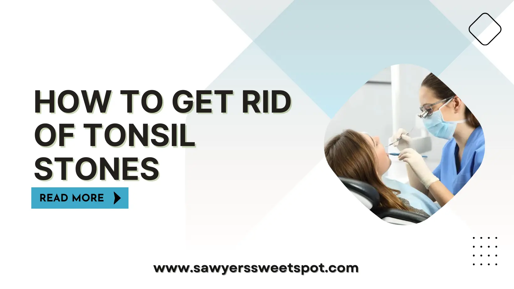 How to Get Rid of Tonsil Stones Without Surgery?